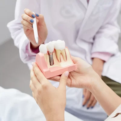 tooth-implantation-model